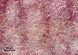 4 - Cellule corticali in visione superficiale